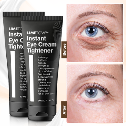 📢📢Last Day Discount🎈 LIMETOW™  Instant Eye Cream tightener