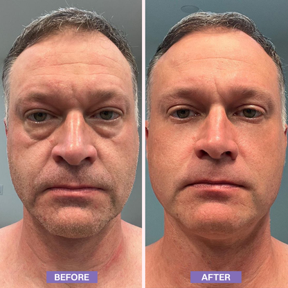 LIMETOW® Instant Lift Eye Gel
