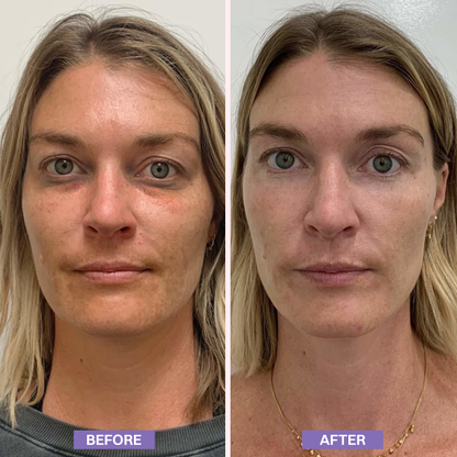 LIMETOW® Instant Lift Eye Gel