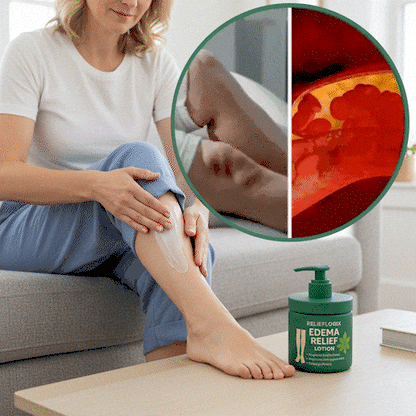 #1 Best Seller- 💥EDEMA RELIEF LOTION