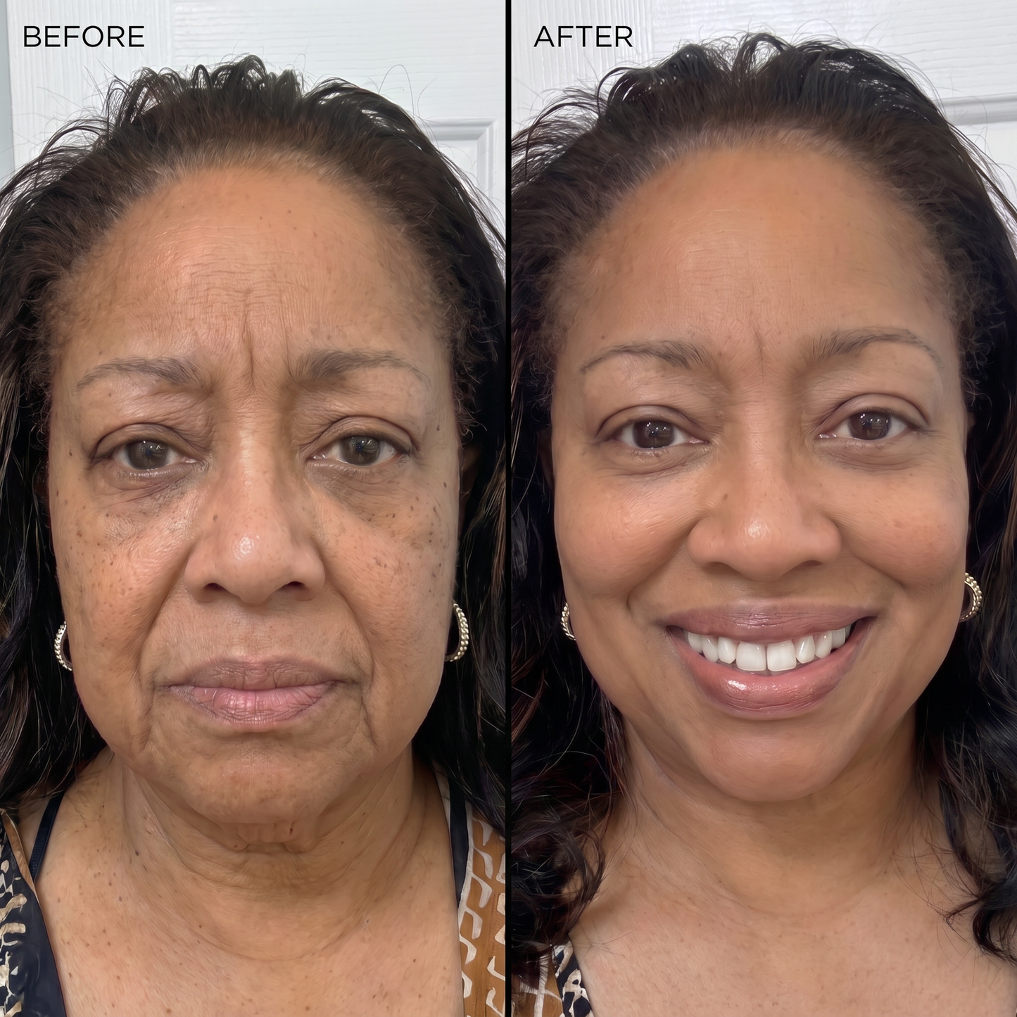 PORE PERFECTING COLLAGEN PEPTIDE SERUM