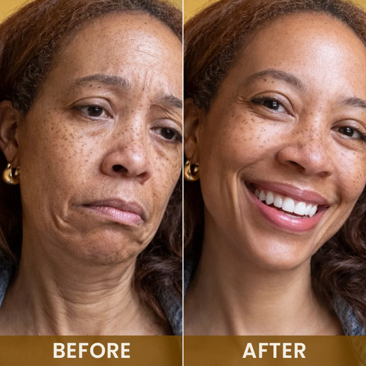 LIMETOW® 24K Gold Anti-Wrinkle Mask🔥 LIMITED SPECIAL OFFER 🔥