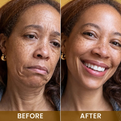 LIMETOW® 24K Gold Anti-Wrinkle Mask🔥 LIMITED SPECIAL OFFER 🔥