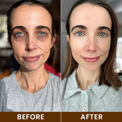 LIMETOW® Intensive Bee Venom Eye Cream