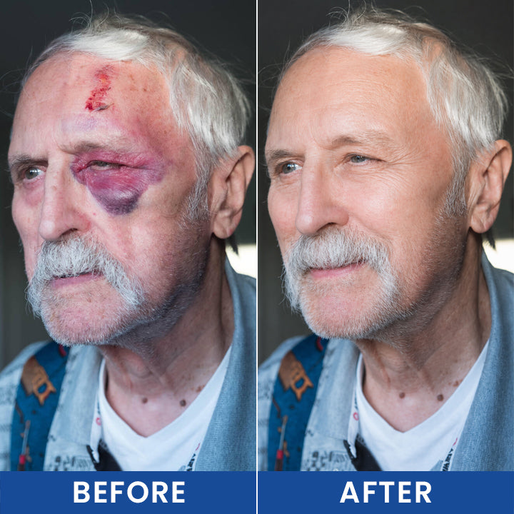 LIMETOW® Intensive Arnica Bruising Cream
