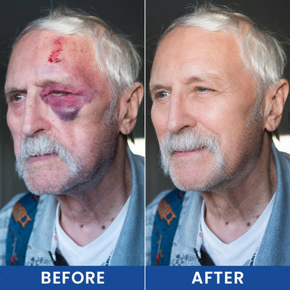 LIMETOW® Intensive Arnica Bruising Cream