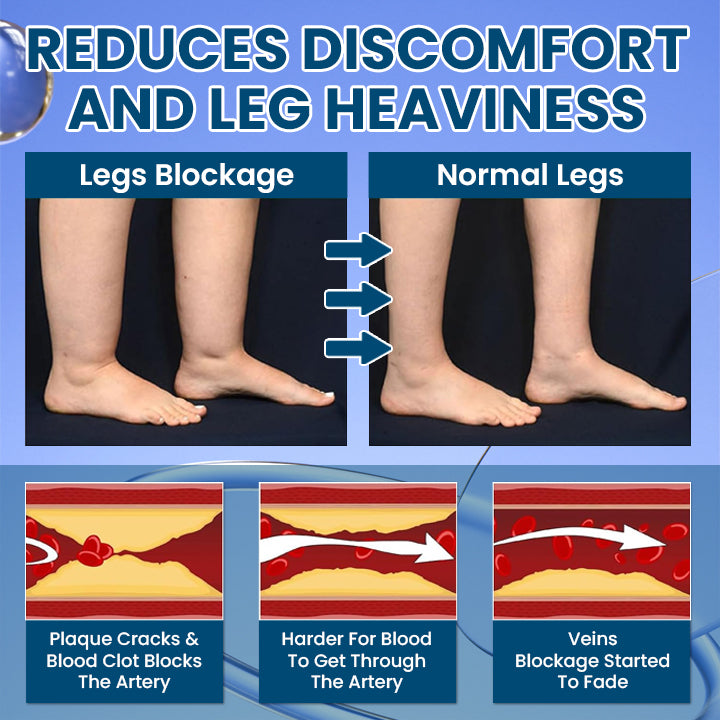 LIMETOW® Roll-On Relief Cream for Swelling & Lymphatic Drainage