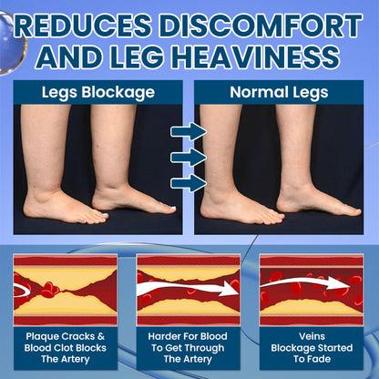 LIMETOW® Roll-On Relief Cream for Swelling & Lymphatic Drainage