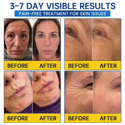 PDRN WRINKLE LIFT TIGHTENING CREAM 🌊