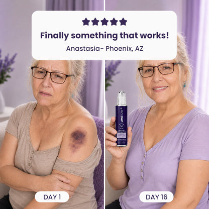 LIMETOW®  Bruise Repair Roll-On