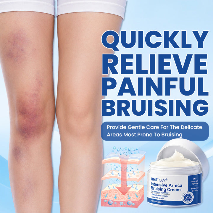 LIMETOW® Intensive Arnica Bruising Cream