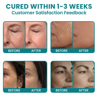 LIMETOW®Dual Action Real Deep Collagen Sheets for both wrinkle smoothing and new or old scar fading
