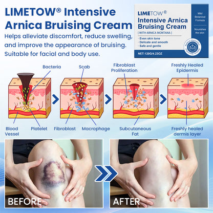 LIMETOW® Intensive Arnica Bruising Cream