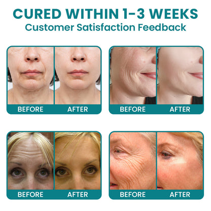 LIMETOW®Dual Action Real Deep Collagen Sheets for both wrinkle smoothing and new or old scar fading