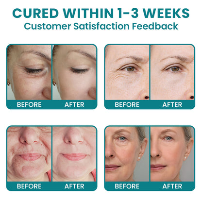 LIMETOW®Dual Action Real Deep Collagen Sheets for both wrinkle smoothing and new or old scar fading