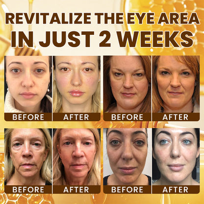 LIMETOW® Intensive Bee Venom Eye Cream