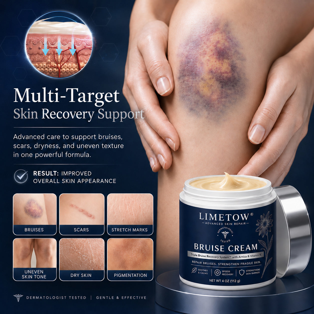 💥300K+ SOLD💕-LIMETOW® Bruise Repair & Skin-Strengthening Cream