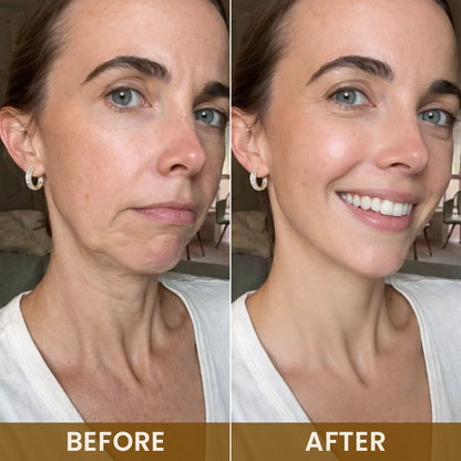 LIMETOW® 24K Gold Anti-Wrinkle Mask🔥 LIMITED SPECIAL OFFER 🔥
