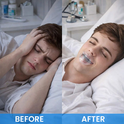 LIMETOW® Anti-Snoring Tongue Sleeve