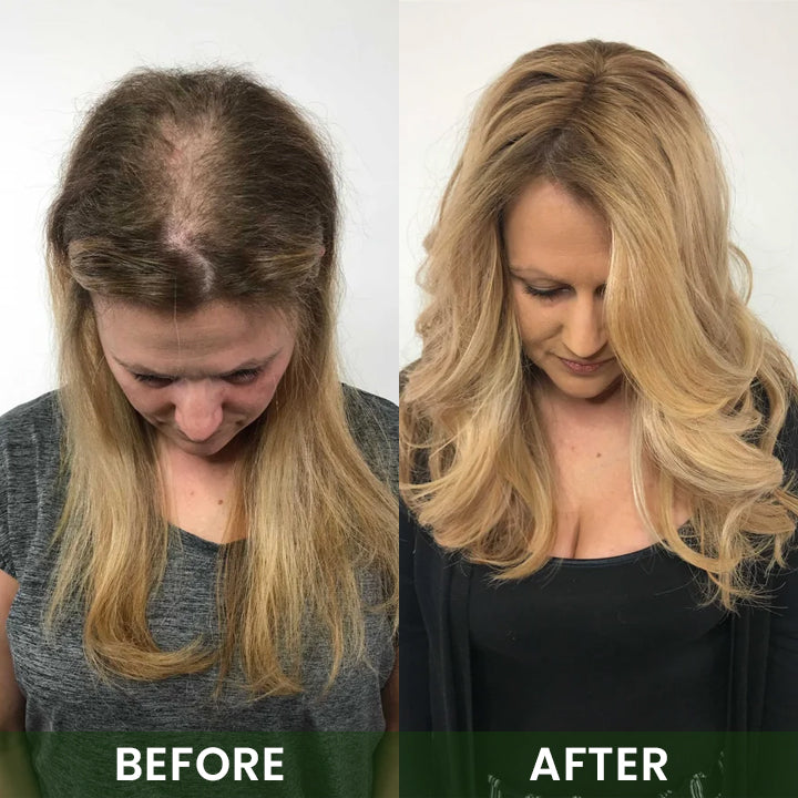 LIMETOW® Hair Boost Spray