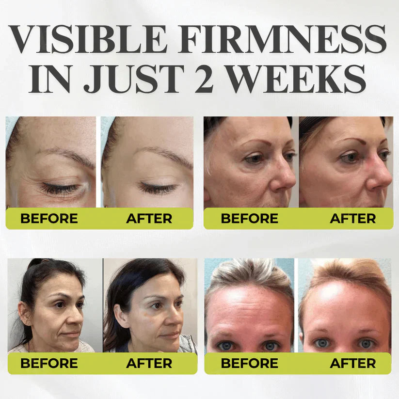 Botox & Vita-A Retinol Shot Wrinkle-Lift Tightening cream👏🌿Made and shipped from the USA 💫