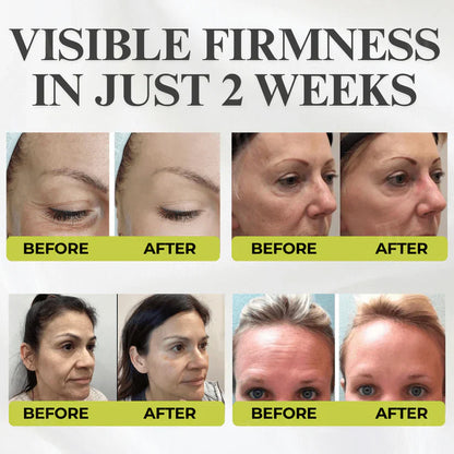 Botox & Vita-A Retinol Shot Wrinkle-Lift Tightening cream👏🌿Made and shipped from the USA 💫