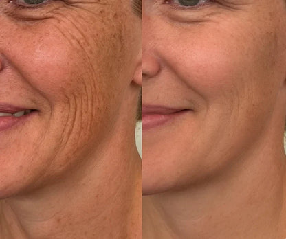 LIMETOW®Dual Action Real Deep Collagen Sheets for both wrinkle smoothing and new or old scar fading