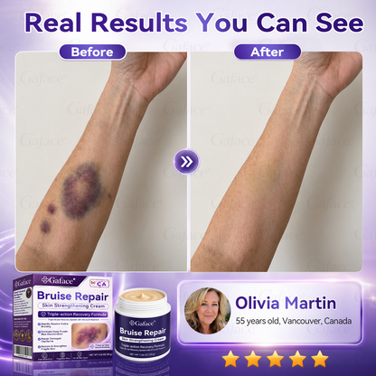 LIMETOW® Bruise Repair & Skin-Strengthening Cream