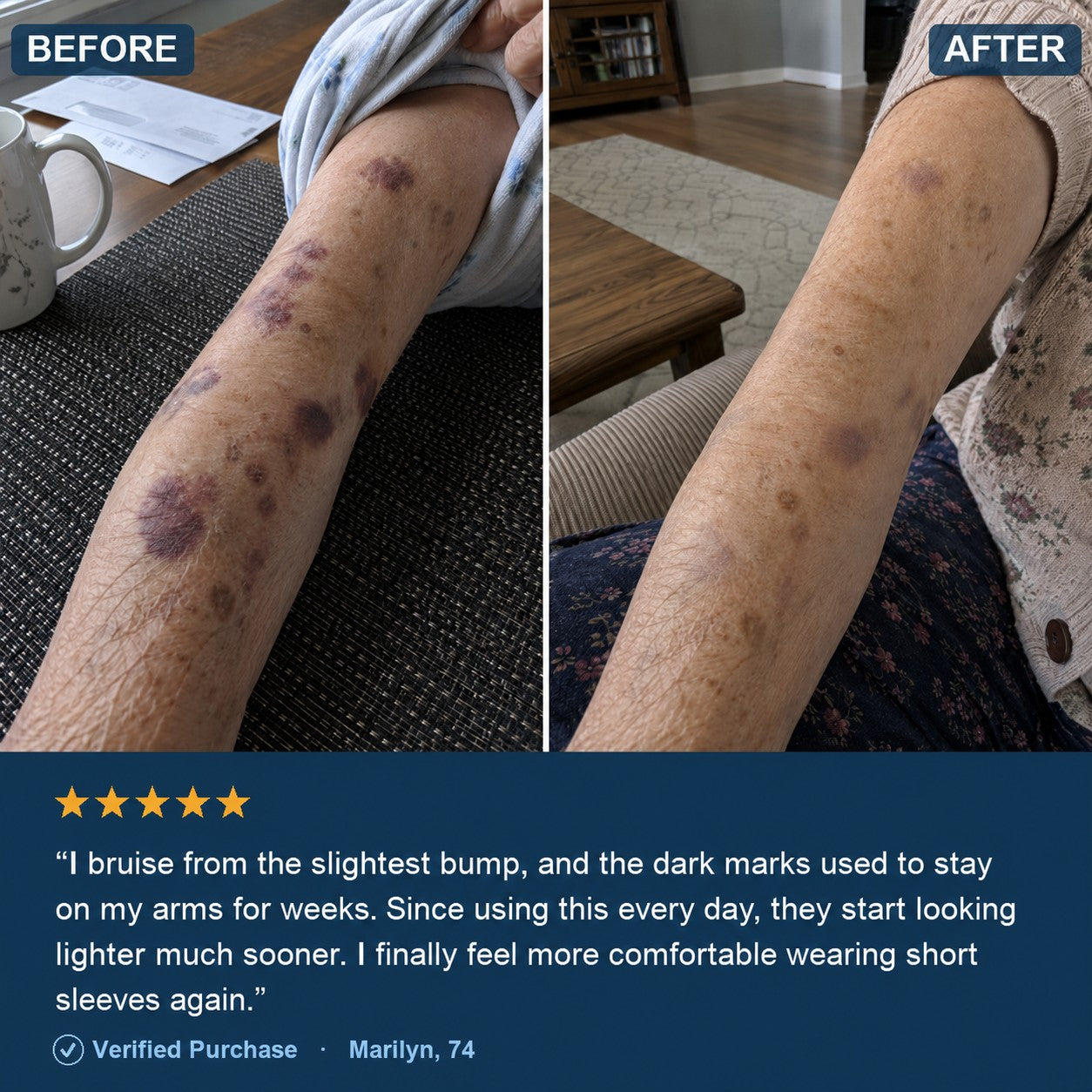 Bruise Defense & Repair Serum