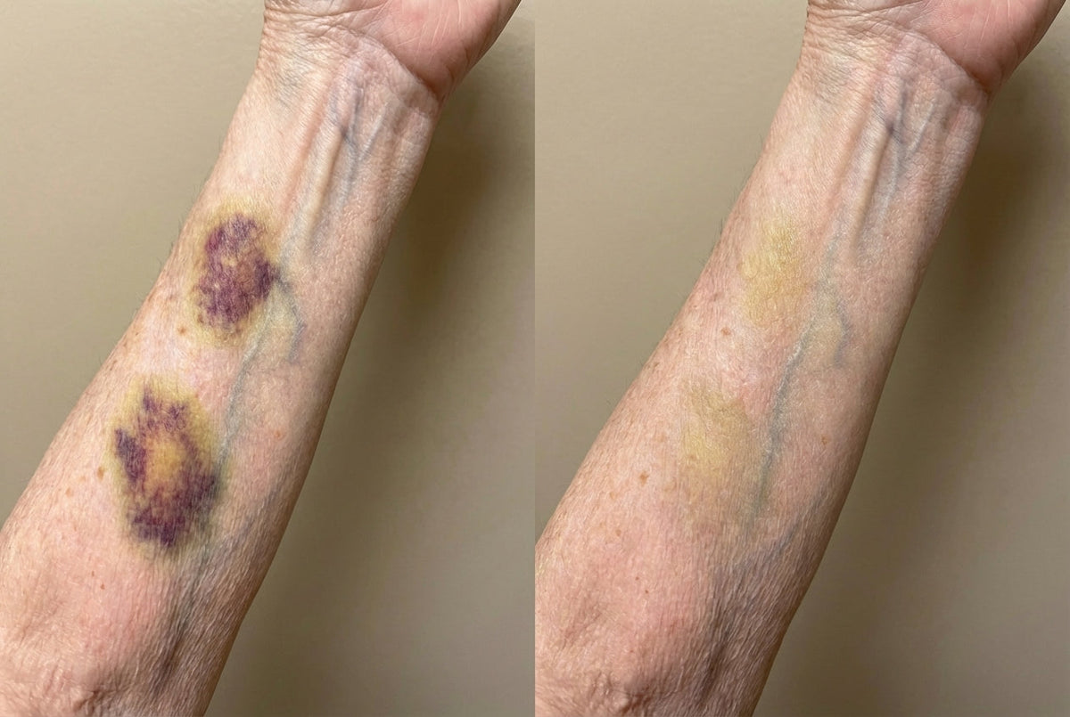 Customer result showing visible skin improvement