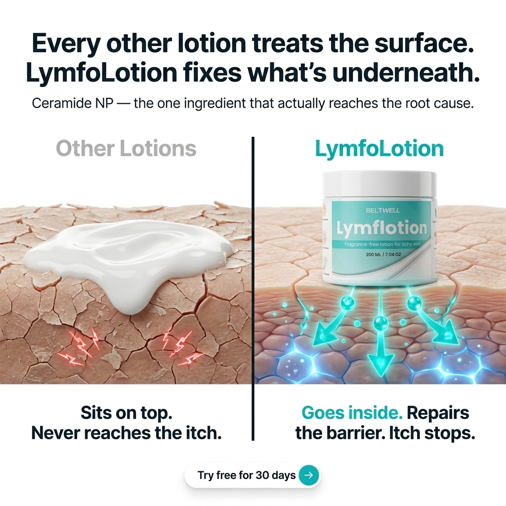 Fragrance-Free Non-Greasy Anti-Itch Ceramide NP Lotion For Dry, Red, Sensitive Skin