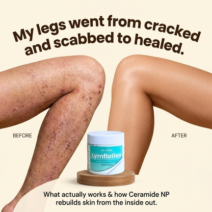 Fragrance-Free Non-Greasy Anti-Itch Ceramide NP Lotion For Dry, Red, Sensitive Skin