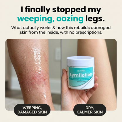 Fragrance-Free Non-Greasy Anti-Itch Ceramide NP Lotion For Dry, Red, Sensitive Skin