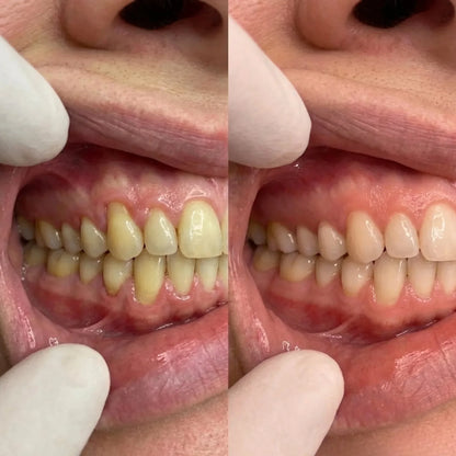 Collagum Smile Strengthening Collagen Powder