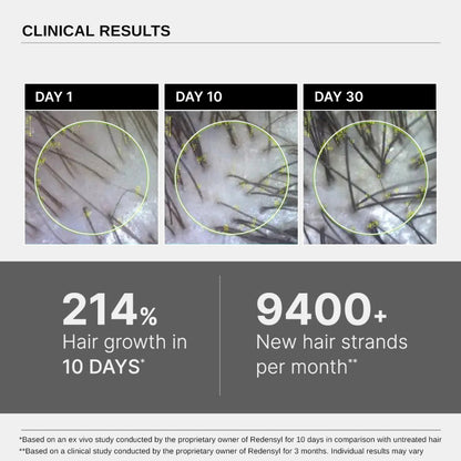 LIMETOW®  Hair Growth Serum